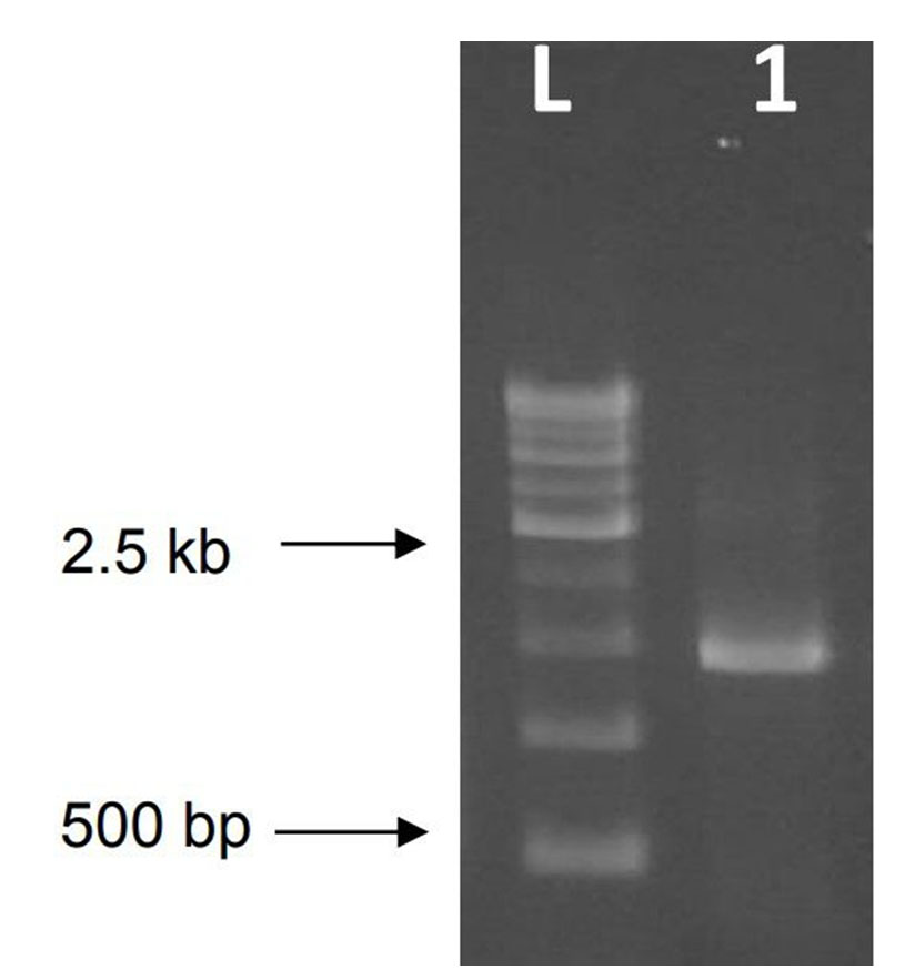 Isolation And Characterization Of Bacteriocin Producing