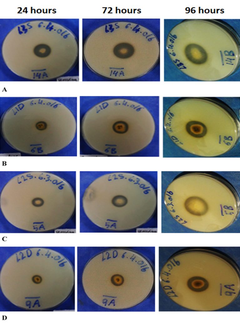 Isolation and Screening of Extracellular Protease Enzyme from Fungal ...