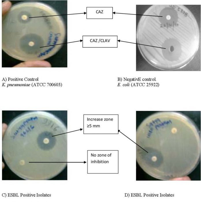 Detection Of Extended Spectrum Lactamases Production By Escherichia   Bilal Ahmad Tantry Fig 5 696x700 