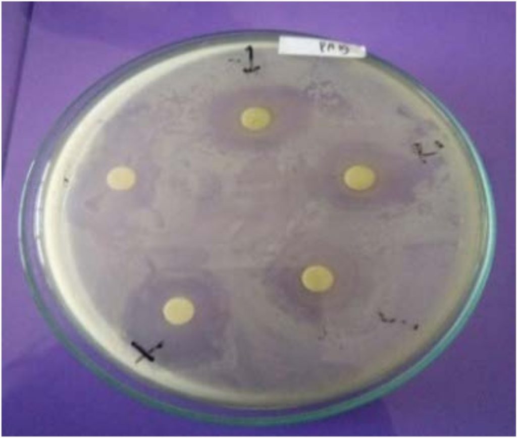 Characteristic Genetics of Heterotrophic Bacteria in Siak River Estuary ...