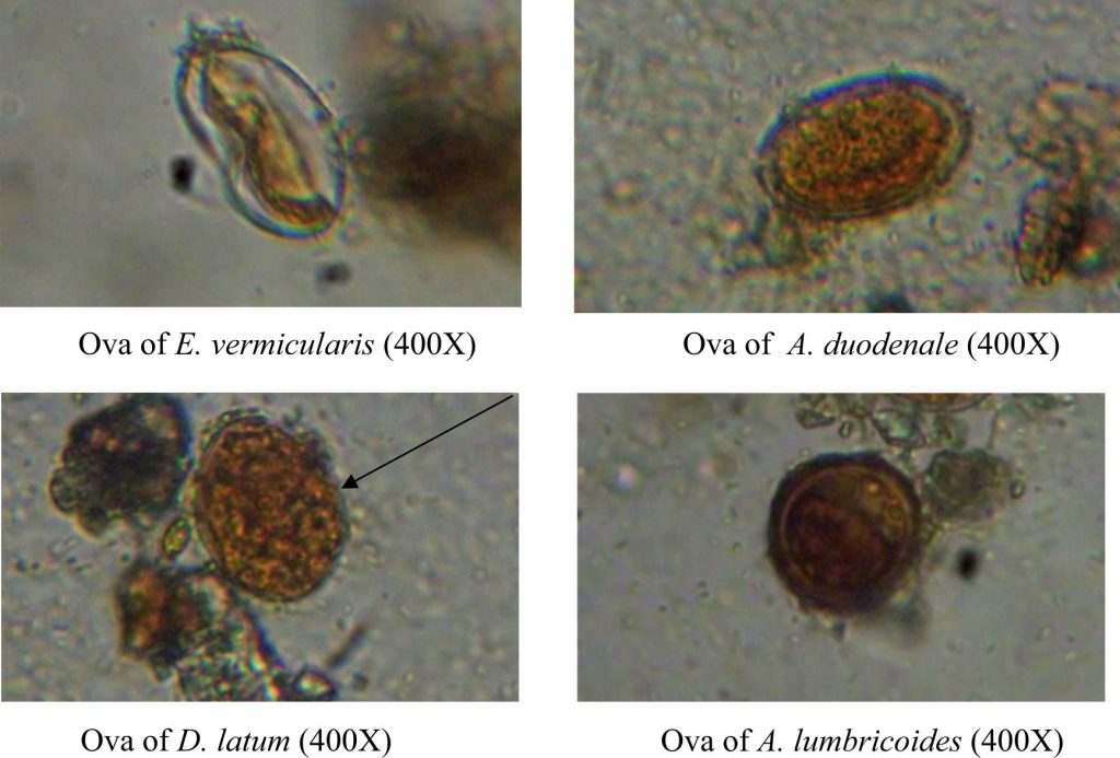 Prevalence of Parasites in Fresh Vegetables from Two Regions of ThiQar Province, Iraq Journal