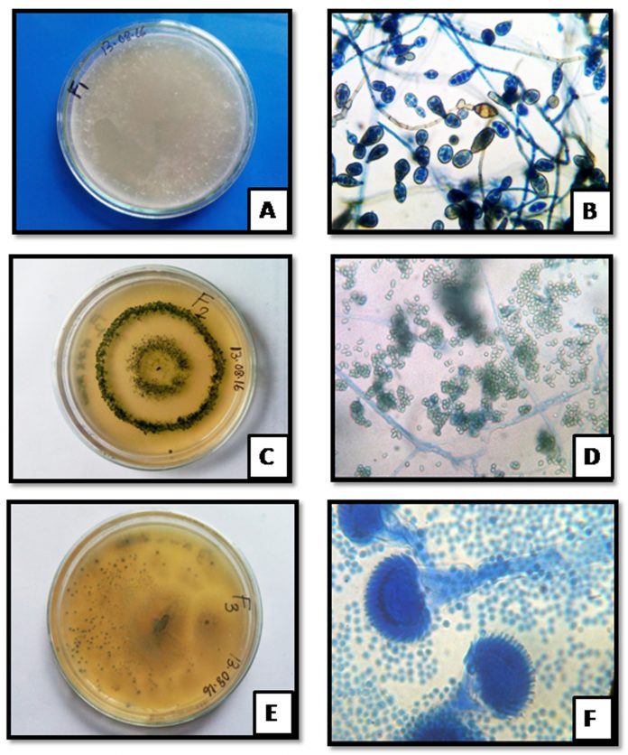 Isolation and Characterization of Dominant Fungi from Rhizospheric Soil ...