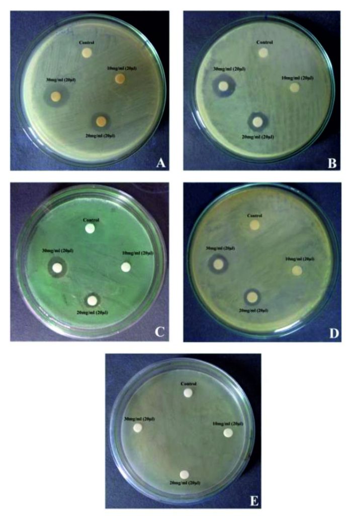 Studies on Phytochemical Screening and Antibacterial Activity of ...