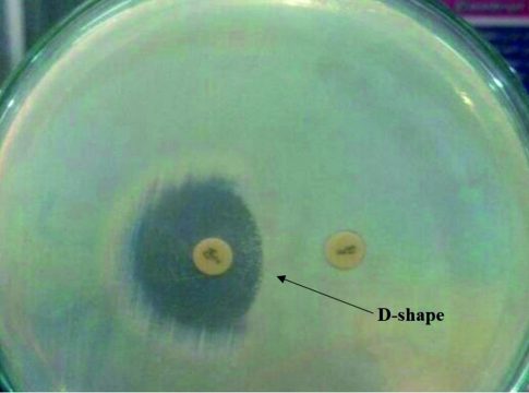 Methicillin and Inducible Clindamycin-Resistant Staphylococcus aureus ...