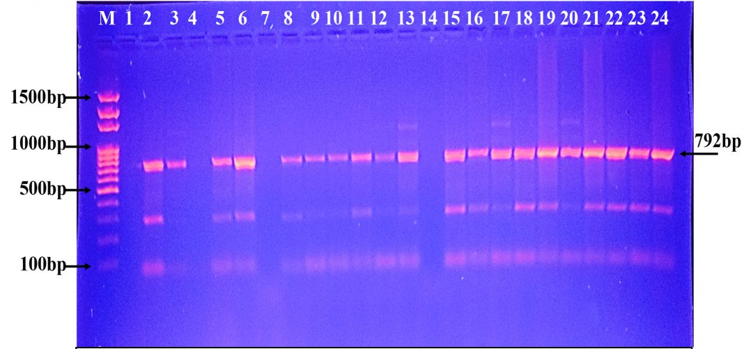 Molecular Detection of Serine Carbapenemase Genes in Carbapenem ...