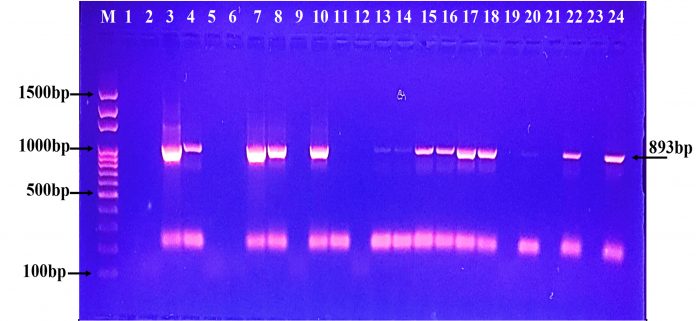 Molecular Detection of Serine Carbapenemase Genes in Carbapenem ...