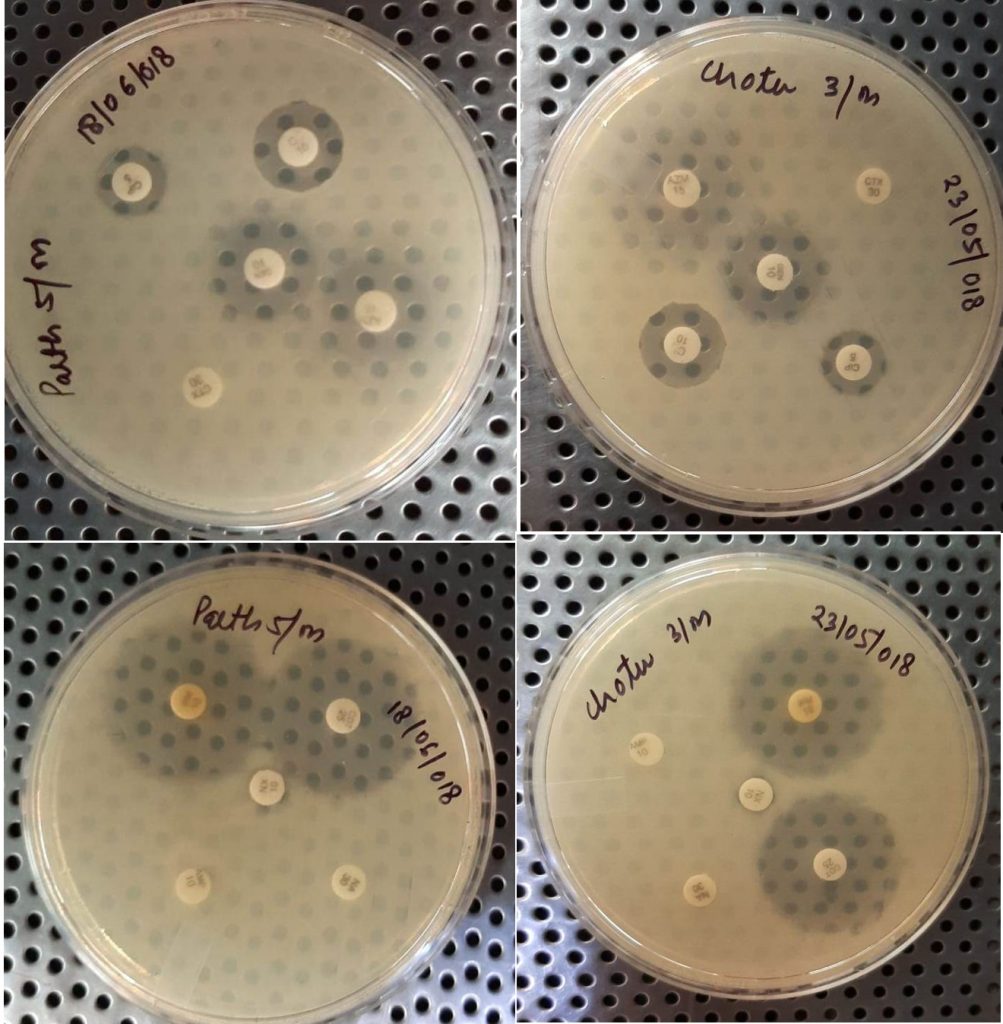 Characterization of Enterotoxigenic and Enterohemorrhagic Escherichia