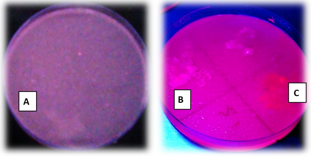 Determination the Lipase Activity of Staphylococcus sp. Strain Isolated from Clinical Specimens