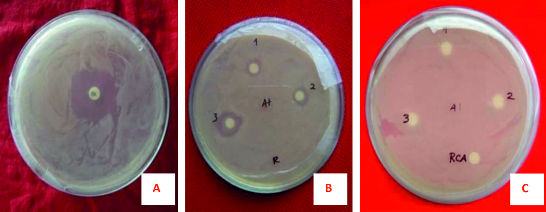 Molecular Detection and Biological Control of Human Hair Dandruff