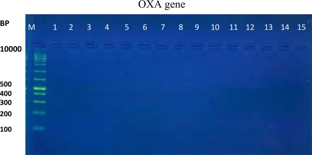 Phenotypic And Genotypic Detection Of Extended-spectrum β-lactamase ...