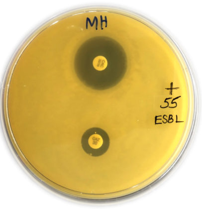 Prevalence Of ESBL Producing Bacteria In Community Acquired UTI From   Fg01 6 406x420 