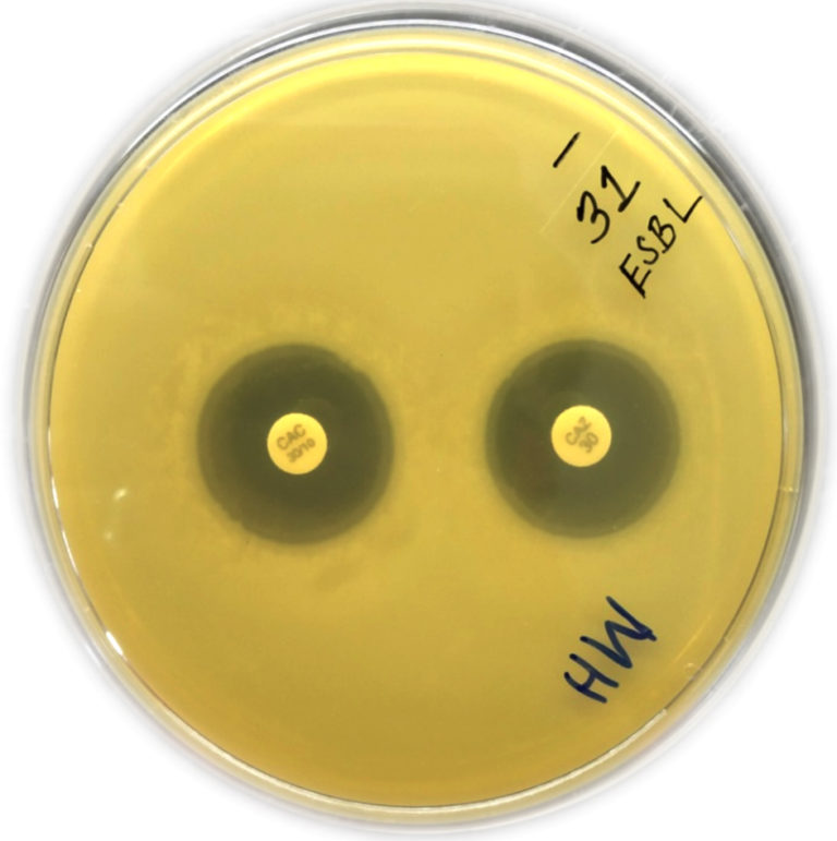 Prevalence Of ESBL Producing Bacteria In Community Acquired UTI From   Fg02 4 768x771 