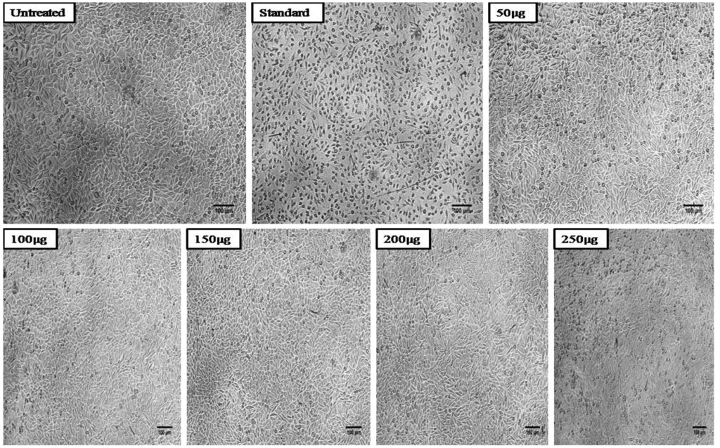 GC-MS Analysis and In-vitro Apoptosis Induction and Anticancer Activity ...