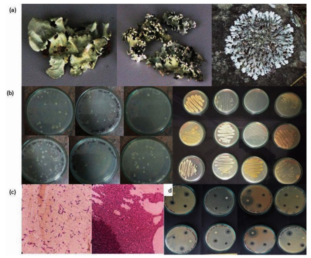 Bioprospecting and Exploration of the Natural Antifouling Approaches ...