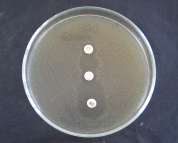 A Guide Towards the Phenotypic Detection of Extended-spectrum β ...