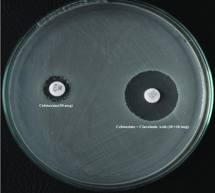 A Guide Towards The Phenotypic Detection Of Extended Spectrum   Fg02 12 E1693226546367 