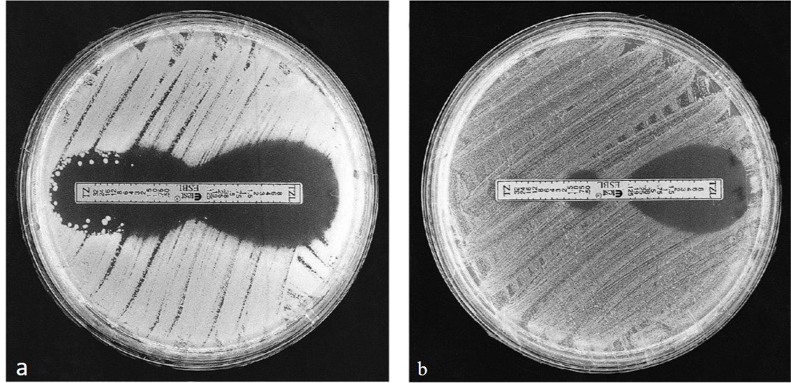 Esbl Types A Guide Towards the Phenotypic Detection of Extended-spectrum β ...