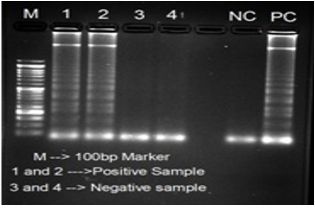 Pure Target Pcr Application of Nested PCR and Loop-Mediated Isothermal Amplification ...