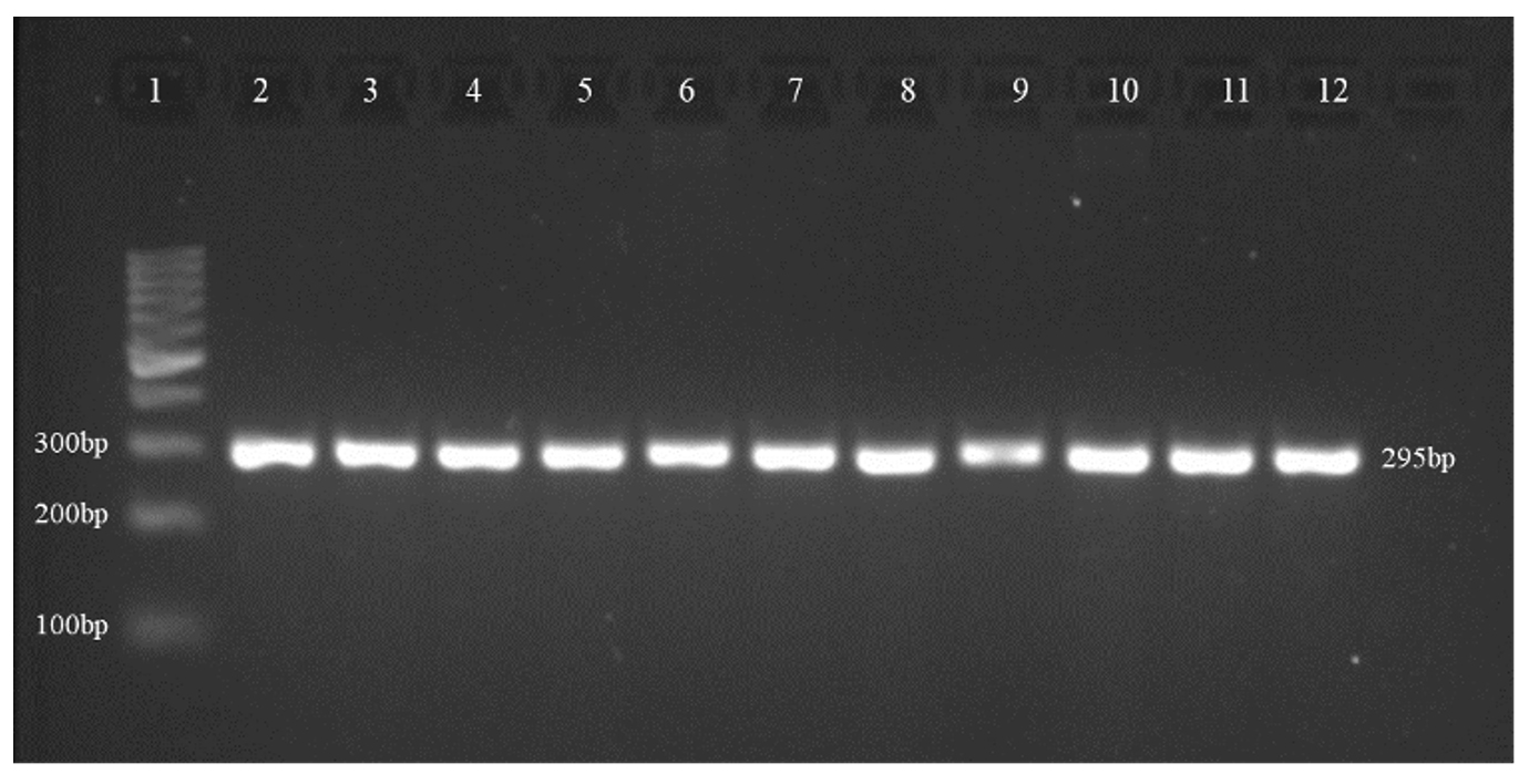 The Virulence Genes of Sensitive Strain Pseudomonas aeruginosa Causing ...