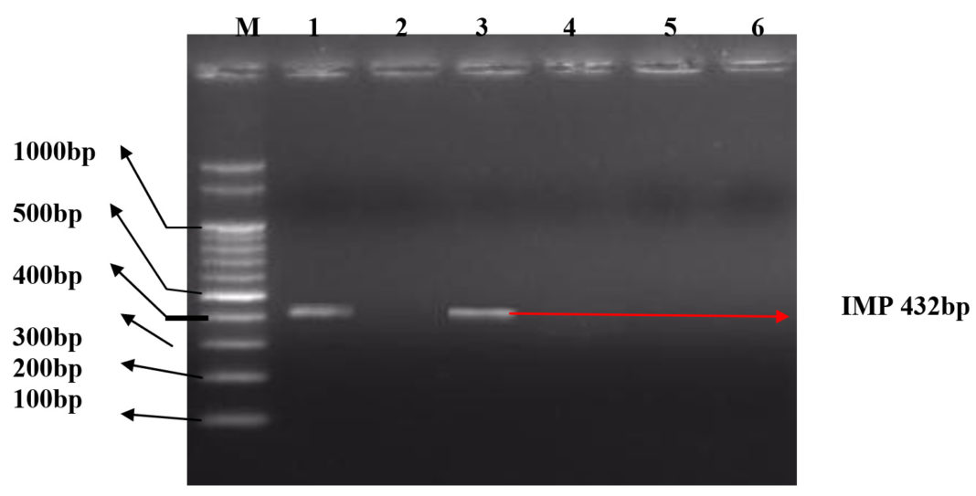 A Study Of Genotypic Characterization Of ESBL And MBL Genes Of   Fg02 8 1068x543 