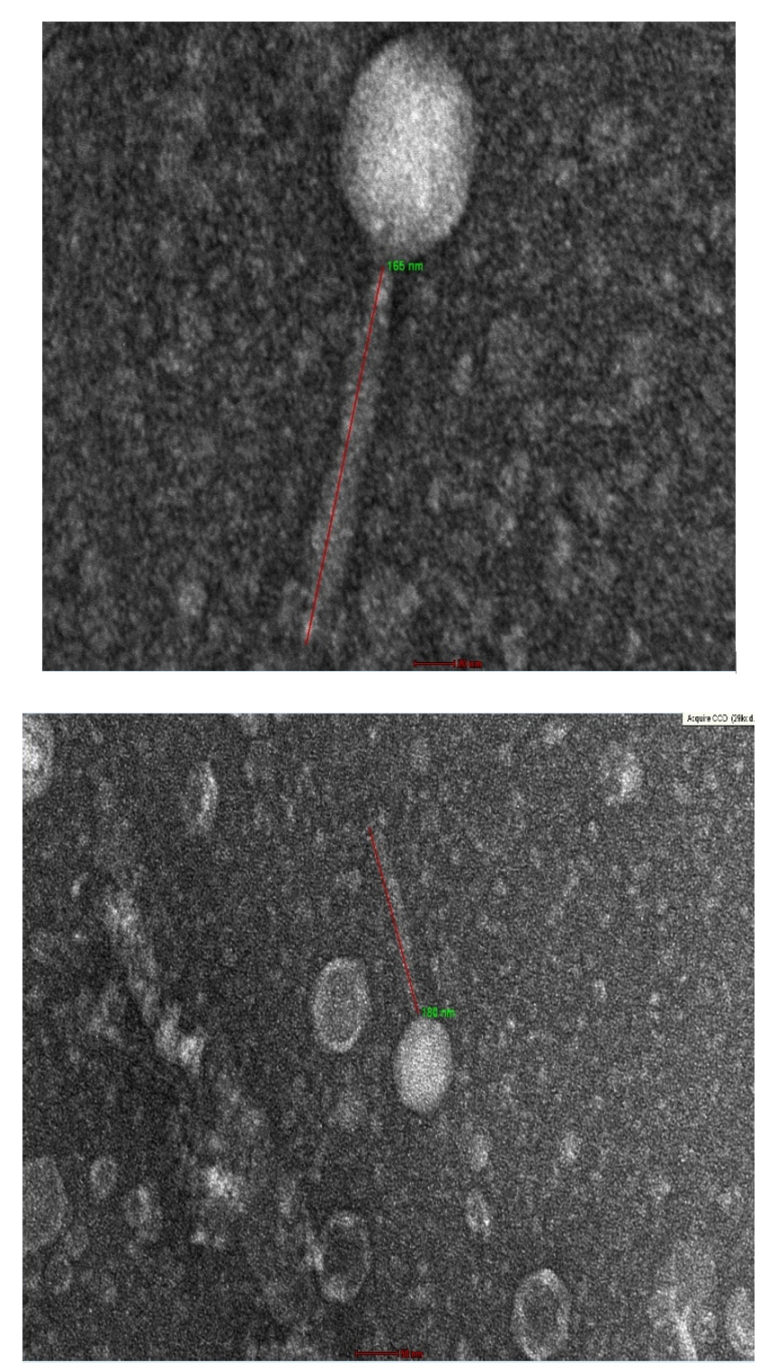 Isolation and Characterization of Highly Lytic Bacteriophages against ...